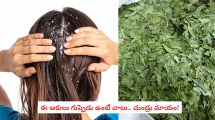 ఈ ఆకులు గుప్పెడు ఉంటే చాలు.. చుండ్రు మాయం!
