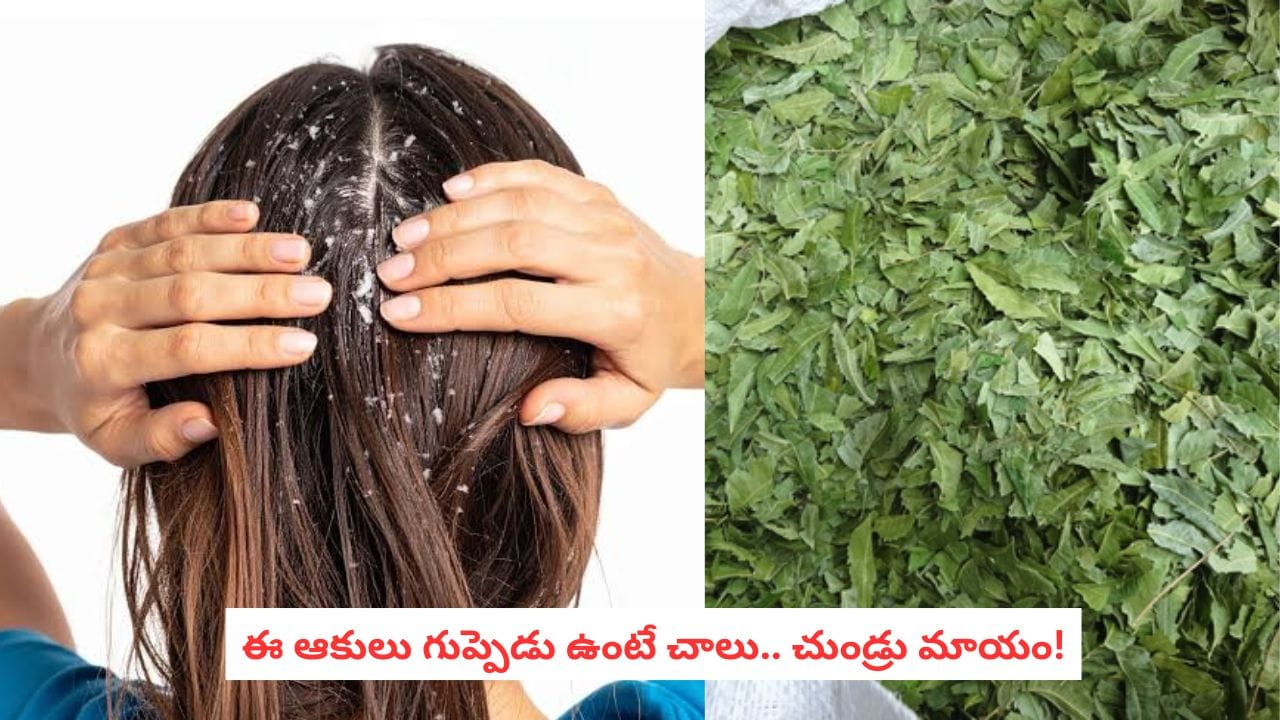 Dandruff Remedies: చుండ్రు పోవడం లేదా? ఇంట్లోనే ఈ ఆకులతో హెయిర్ ప్యాక్ చేసుకోండి!