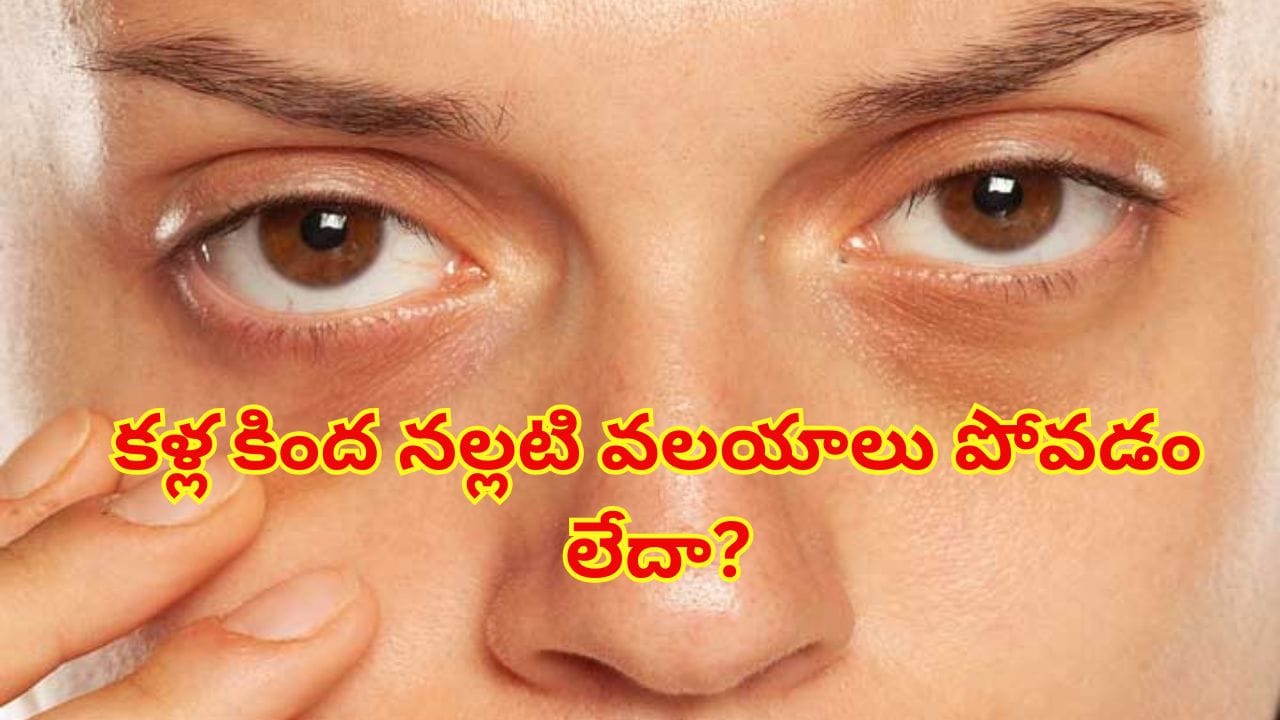 తగినంత నిద్రపోతున్నా కళ్ల కింద నల్లటి వలయాలు ఉంటున్నాయా? నిపుణులు చెబుతున్న అసలు కారణాలు ఇవే!