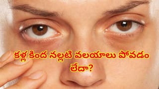 తగినంత నిద్రపోతున్నా కళ్ల కింద నల్లటి వలయాలు ఉంటున్నాయా? నిపుణులు చెబుతున్న అసలు కారణాలు ఇవే!