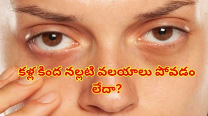 తగినంత నిద్రపోతున్నా కళ్ల కింద నల్లటి వలయాలు ఉంటున్నాయా?