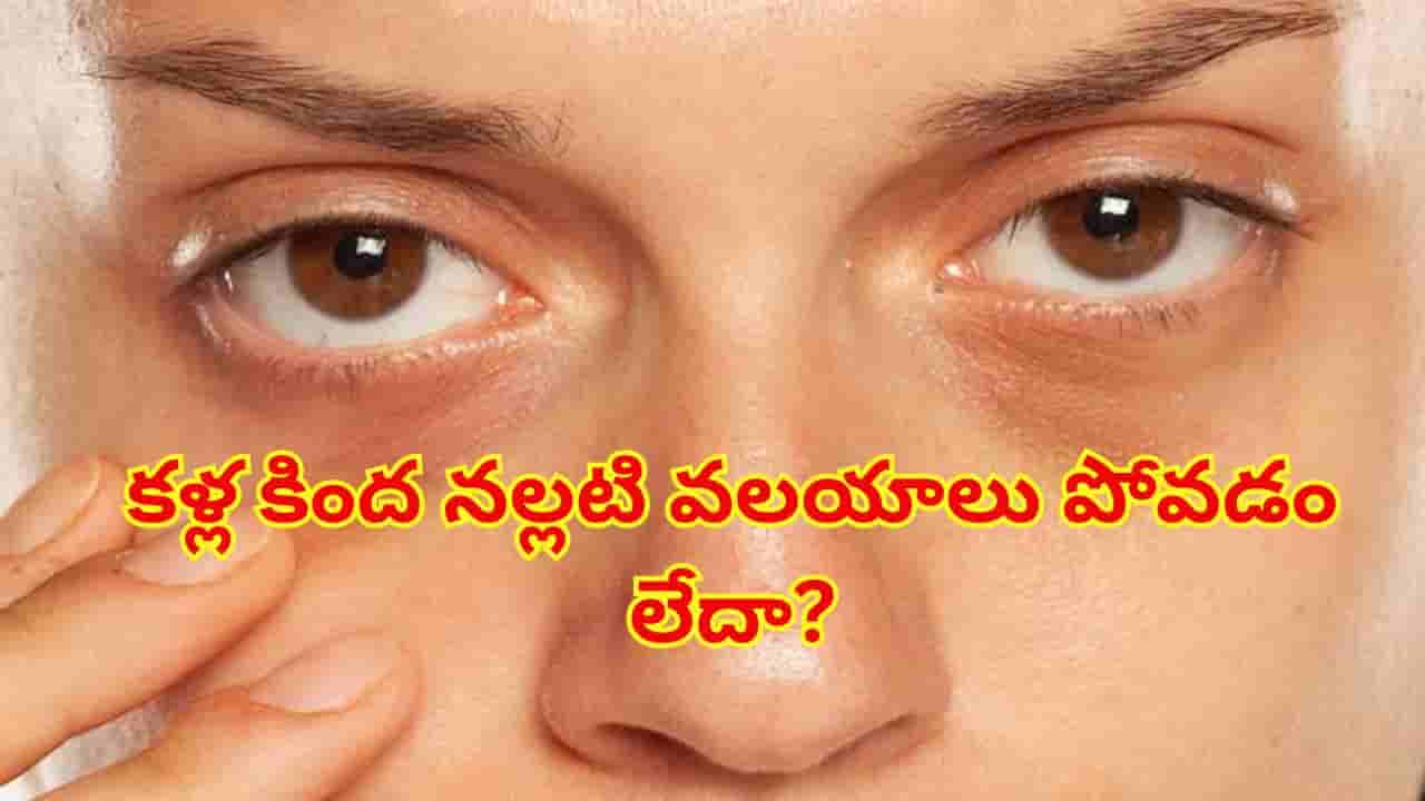 తగినంత నిద్రపోతున్నా కళ్ల కింద నల్లటి వలయాలు ఉంటున్నాయా? నిపుణులు చెబుతున్న అసలు కారణాలు ఇవే!