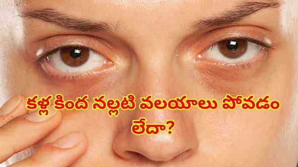 తగినంత నిద్రపోతున్నా కళ్ల కింద నల్లటి వలయాలు ఉంటున్నాయా? నిపుణులు చెబుతున్న అసలు కారణాలు ఇవే!