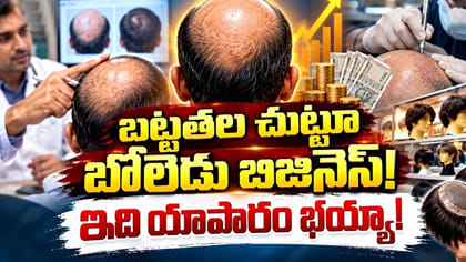 జుట్టు ఊడిపోతుందనే టెన్షన్ వద్దు.. బట్టతలకు దారితీసే అలవాట్లు ఇవే