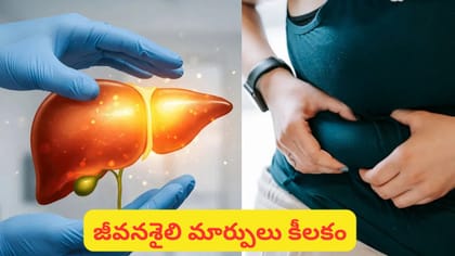 ఫ్యాటీ లివర్ సమస్యా? ఈ 5 ఆహారాలను డైట్‌లో తప్పక చేర్చుకోండి!