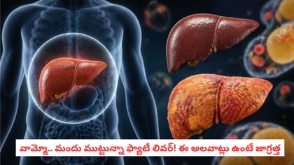 వామ్మో.. మందు ముట్టున్నా ఫ్యాటీ లివర్! ఈ అలవాట్లు ఉంటే జాగ్రత్త