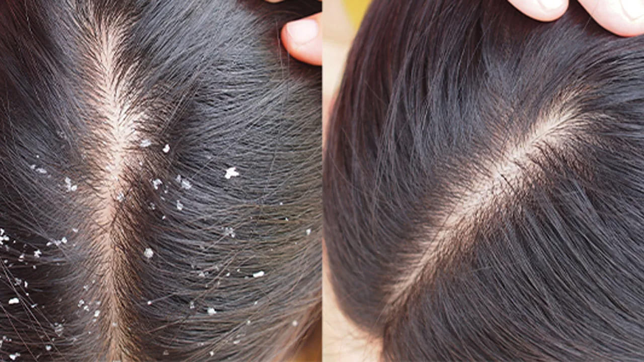 Hair 1