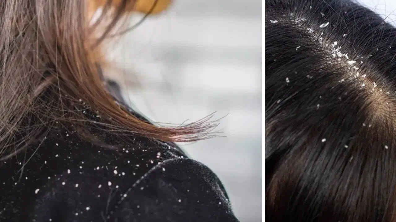 Hair 5