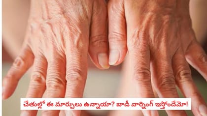 చేతుల్లో ఈ మార్పులు ఉన్నాయా? బాడీ వార్నింగ్ ఇస్తోందేమో!