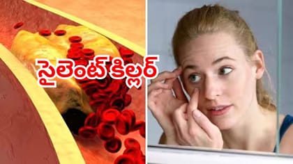 మీ శరీరంలో చెడు కొలెస్ట్రాల్ పెరిగిందని చెప్పే హెచ్చరిక సంకేతాలు!