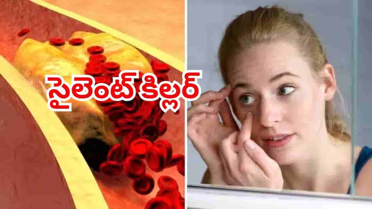 మీ శరీరంలో చెడు కొలెస్ట్రాల్ పెరిగిందని చెప్పే హెచ్చరిక సంకేతాలు! నిర్లక్ష్యం చేశారంటే మొదటికే మోసం!!