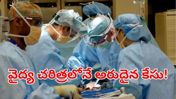 Rare PMDS Case: అబ్బాయి శరీరంలో గర్భాశయం.. పిల్లలు పుట్టట్లేదని హాస్పిటల్కు వెళ్లగా..