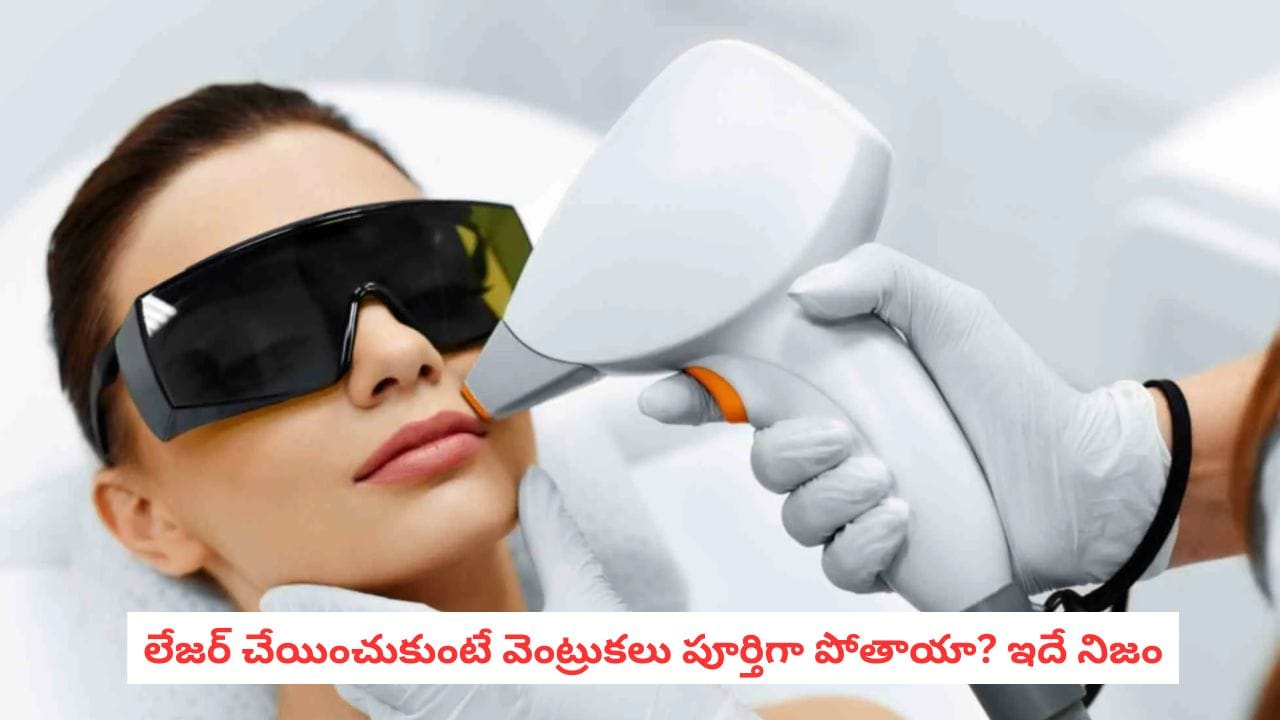 Laser Hair Removal: లేజర్ హెయిర్ రిమూవల్ చేయించుకోబోతున్నారా? ఈ విషయాలు తెలుసుకోవాల్సిందే!