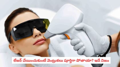లేజర్ చేయించుకుంటే వెంట్రుకలు పూర్తిగా పోతాయా? ఇదే నిజం