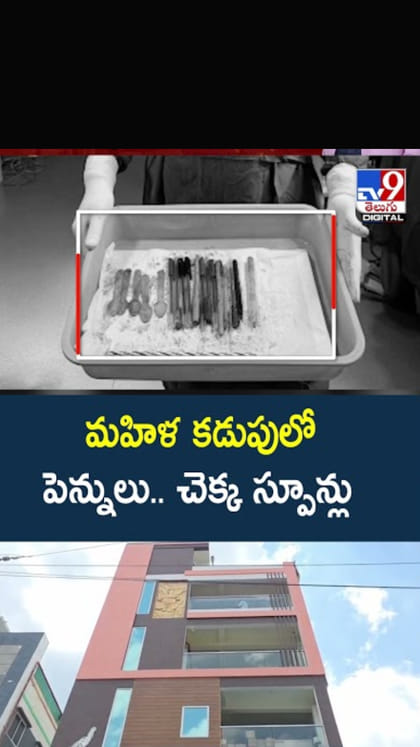 మహిళ కడుపులో పెన్నులు.. చెక్క స్పూన్లు