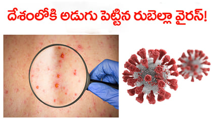జార్ఖండ్‌లో రుబెల్లా కలకలం.. 10 ఏళ్ల బాలికకు వైరస్!