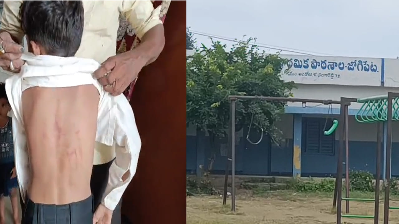 Telangana: 1 నుంచి 30 అంకెలు చెప్పలేదని విద్యార్థిని చితకబాదిన టీచర్