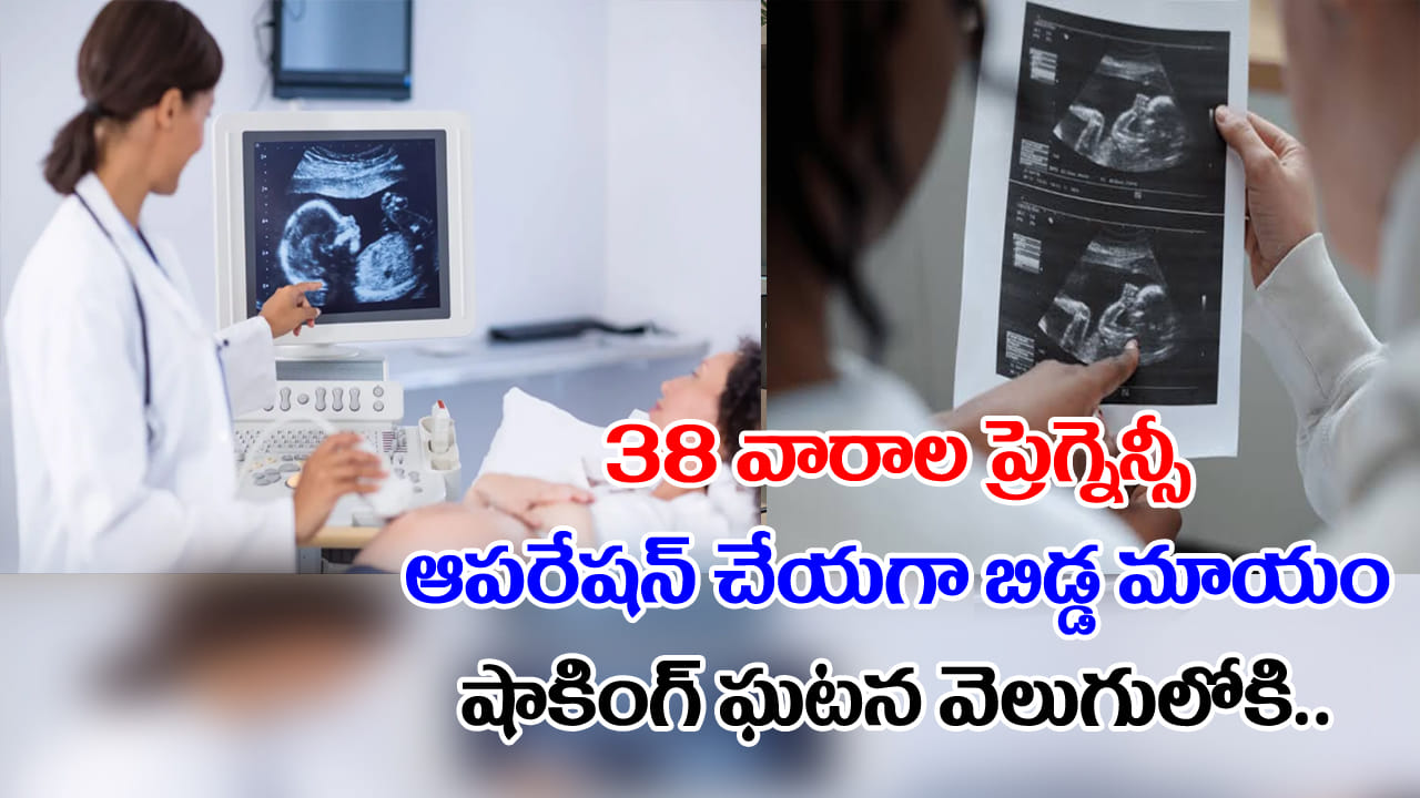 Pregnancy: 9 నెలల గర్భం.. ఆపరేషన్ చేయగా కడుపులో బిడ్డ మాయం.. డాక్టర్లు షాక్.. మైండ్ బ్లోయింగ్ నిజం!