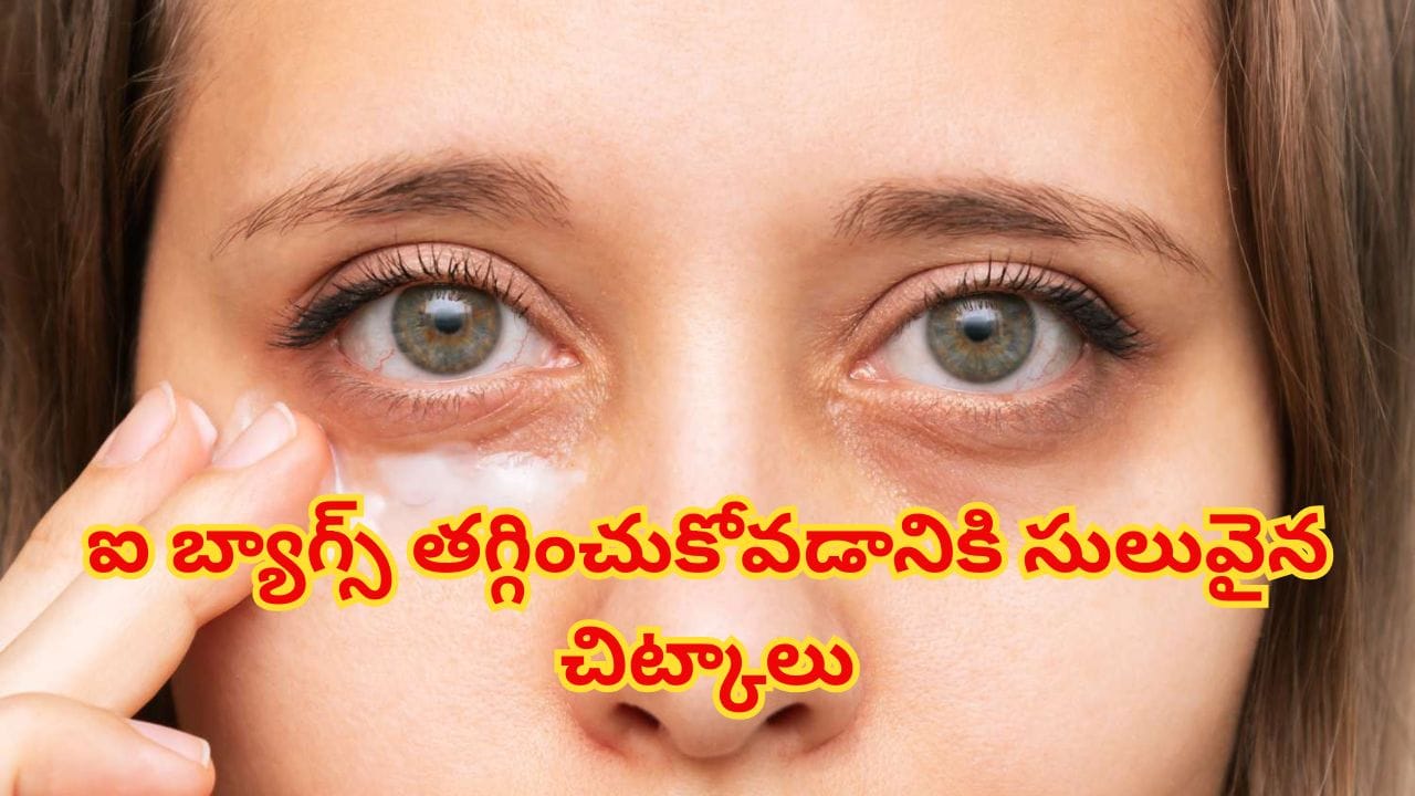 కళ్ల కింద వాపుతో బాధపడుతున్నారా? నిపుణులు సూచించే కారణాలు, నివారణ మార్గాలు ఇవే!