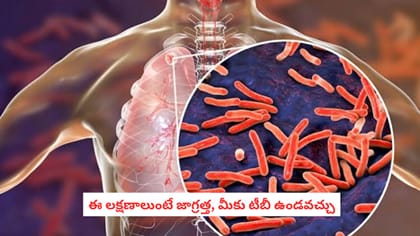 ఈ లక్షణాలుంటే జాగ్రత్త, మీకు టీబీ ఉండవచ్చు