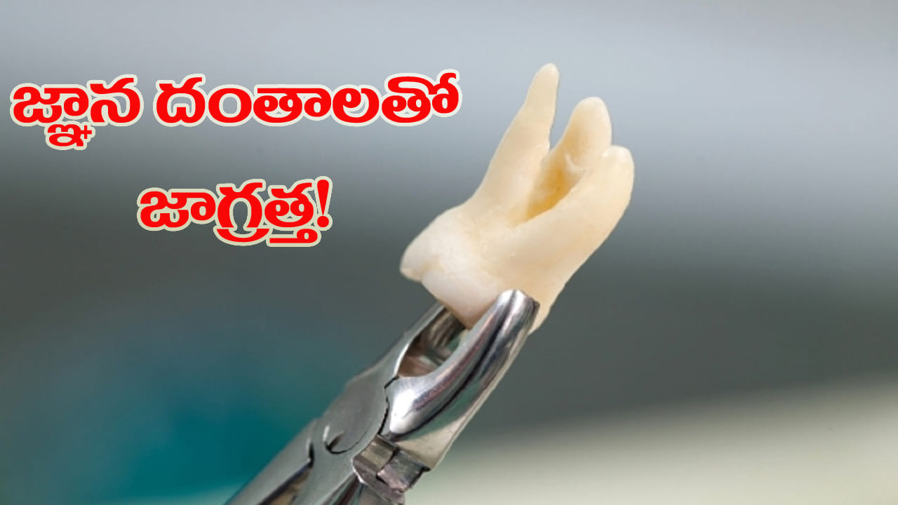 Wisdom Teeth: జ్ఞాన దంతాలు వస్తున్నాయా? ఈ లక్షణాలు కనిపిస్తే అస్సలు నిర్లక్ష్యం చేయొద్దు!