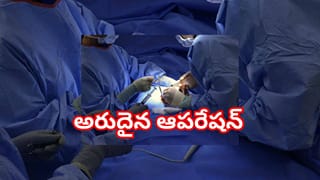 9నెలల గర్భిణీల ఆస్పత్రికి వచ్చిన మహిళ.. ఆపరేషన్‌ చేసిన వైద్యులు షాక్..! 4 కిలోల బరుతో..