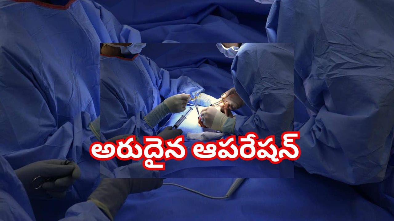 9నెలల గర్భిణీల ఆస్పత్రికి వచ్చిన మహిళ.. ఆపరేషన్ చేసిన వైద్యులు షాక్..! 4 కిలోల బరుతో..