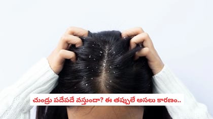 చుండ్రు పదేపదే వస్తుందా? ఈ తప్పులే అసలు కారణం..