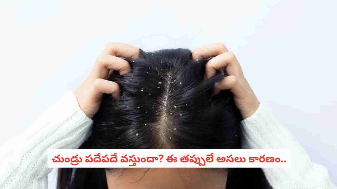 Dandruff Causes: చుండ్రు పోయి మళ్లీ వస్తుందా? రోజూ చేసే ఈ తప్పులే కారణం కావచ్చు!