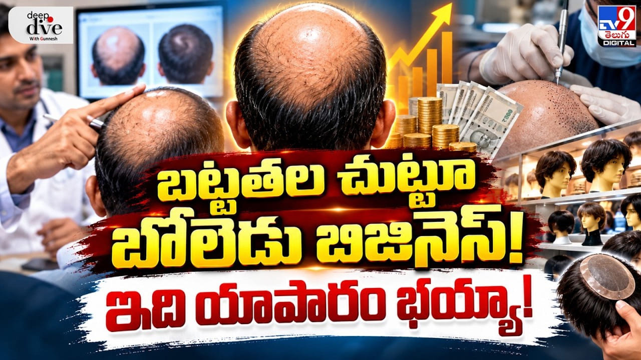 Baldness: బట్టతల చుట్టూ బోలెడు బిజినెస్! ఇది యాపారం భయ్యా!