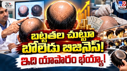 బట్టతల చుట్టూ బోలెడు బిజినెస్! ఇది యాపారం భయ్యా!