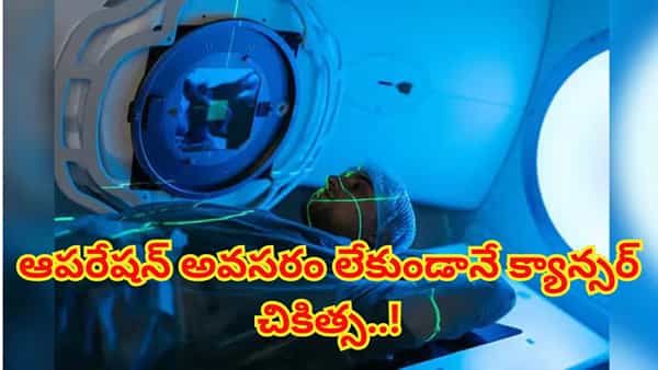 క్యాన్సర్కు సర్జరీ చేయించుకోవాల్సిందేనా? రేడియేషన్ థెరపీపై కీలక విషయాలు!
