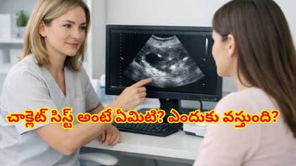 మహిళల్లో చాక్లెట్ సిస్ట్ సమస్య అంటే ఏమిటి? దాని లక్షణాలు, కారణాలు