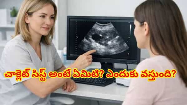 మహిళల్లో చాక్లెట్ సిస్ట్ సమస్య అంటే ఏమిటి? దాని లక్షణాలు, కారణాలు, చికిత్స విధానాలు ఇవే!