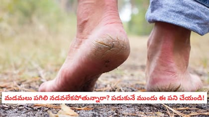 మడమలు పగిలి నడవలేకపోతున్నారా? రాత్రి పడుకునే ముందు ఈ పని చేయండి!