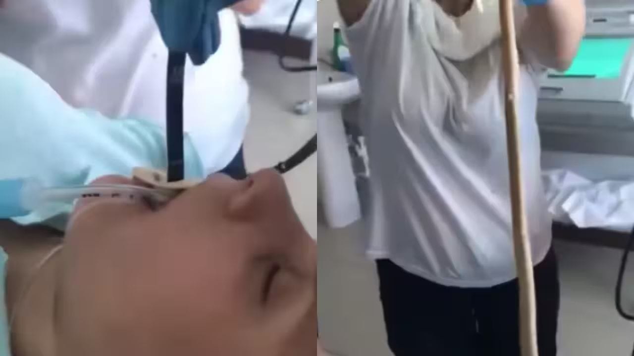 Viral Video: ఛాతీలో మంటతో ఆసుపత్రికి మహిళ .. ఎండోస్కోపీ చూసి వైద్యులు షాక్‌!