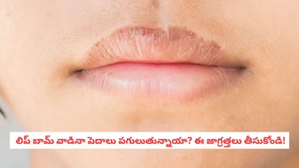  లిప్ బామ్ వాడినా పెదాలు పగులుతున్నాయా? ఈ జాగ్రత్తలు తీసుకోండి!