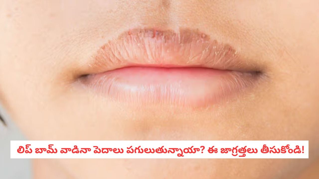 Dry Lips: లిప్ బామ్ రాస్తున్నా పెదాలు పొడిబారుతున్నాయా? మీరే చేస్తున్న ఈ తప్పులే కారణం కావచ్చు!