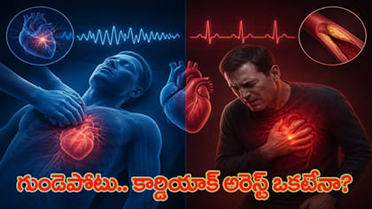 కార్డియాక్ అరెస్ట్.. గుండెపోటు ఒకటేనా?
