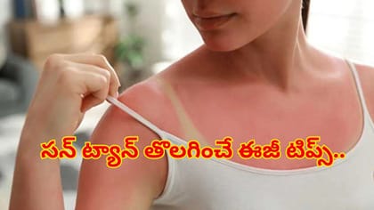 ఎండ వల్ల మీ ముఖం, చేతులు, పాదాలు రంగు మారాయా?ఈ సింపుల్‌ చిట్కాలతో