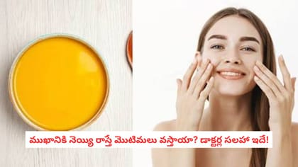 ముఖానికి నెయ్యి రాస్తే మొటిమలు వస్తాయా? డాక్టర్ల సలహా ఇదే!