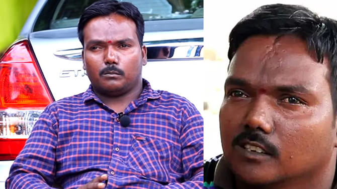 సోషల్ మీడియా ఫేమ్ అగ్గిపెట్టి మచ్చ మృతి..