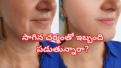 మెడపై ముడతలు, సాగిన చర్మంతో ఇబ్బంది పడుతున్నారా? హోమ్‌మేడ్ చిట్కా