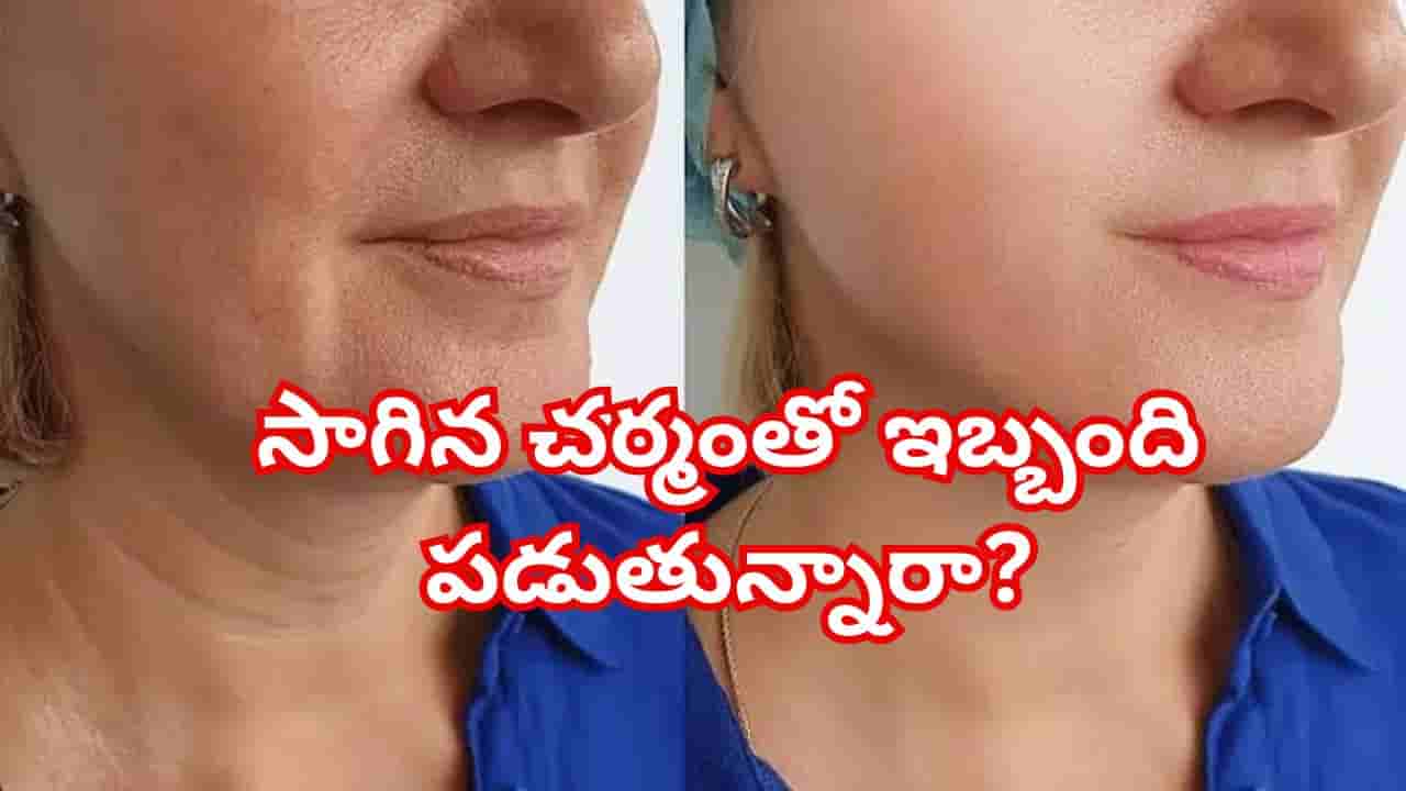 మెడపై ముడతలు, సాగిన చర్మంతో ఇబ్బంది పడుతున్నారా? ఈ 5 హోమ్మేడ్ చిట్కాలతో చెక్ పెట్టండి!