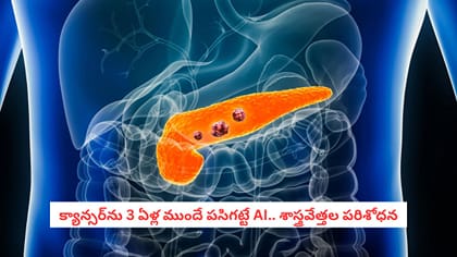  వామ్మో.. డాక్టర్ల కన్నా మూడేళ్ల ముందే క్యాన్సర్‌ కు AI చెక్!