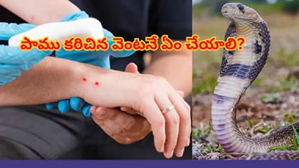 పాము కరిచిన వెంటనే ఏం చేయాలి?ప్రాణాలు కాపాడే ప్రథమ చికిత్సలు!