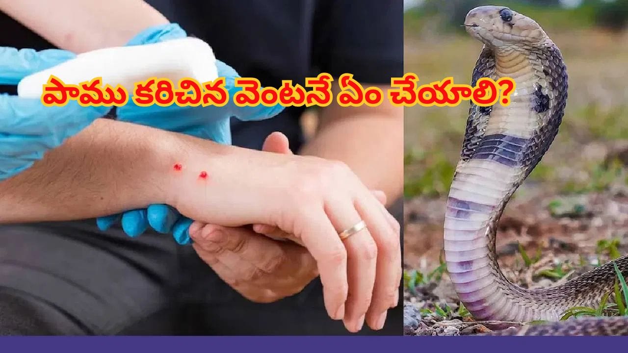 పాము కరిచిన వెంటనే ఏం చేయాలి? ప్రాణాలు కాపాడే కీలకమైన ప్రథమ చికిత్స చిట్కాలు!