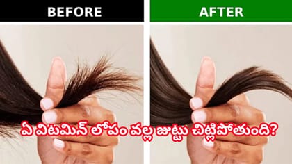 జుట్టు చివర్లు చిట్లిపోతున్నాయా? అసలు కారణం ఇదే..శాశ్వత పరిష్కారం